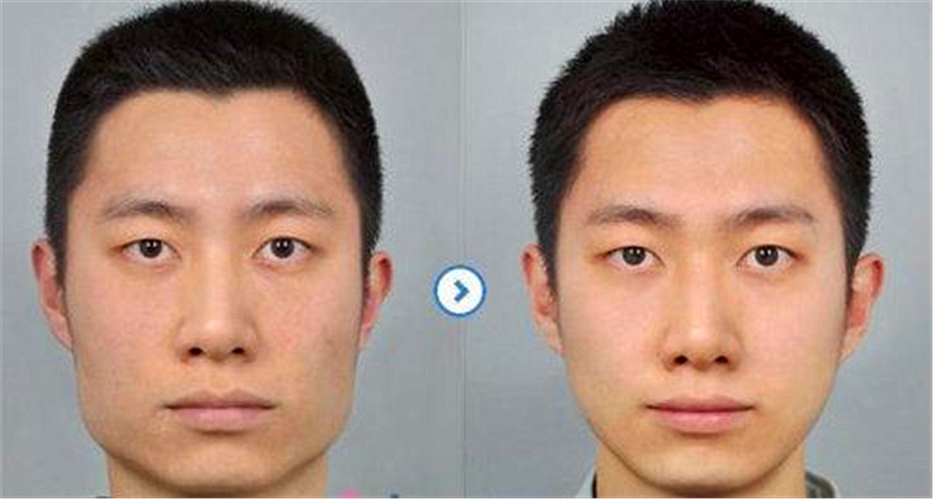 国际公认的“软*品毒**”槟榔，6000万国人却嚼个不停，偏不听劝