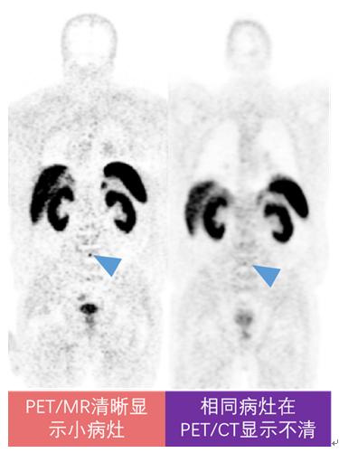 哈医大一院磁共振有片吗,哈医大一院能做内耳磁共振吗