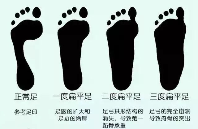 孩子脚跟疼是什么原因,孩子脚疼还肿怎么回事