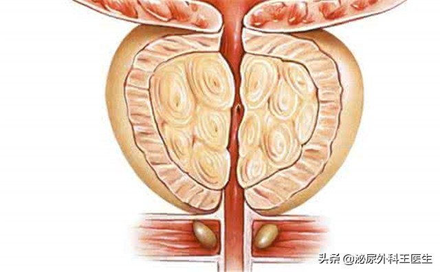 肛门潮湿瘙痒是湿热症状吗,肛门潮湿瘙痒还有味怎么治疗