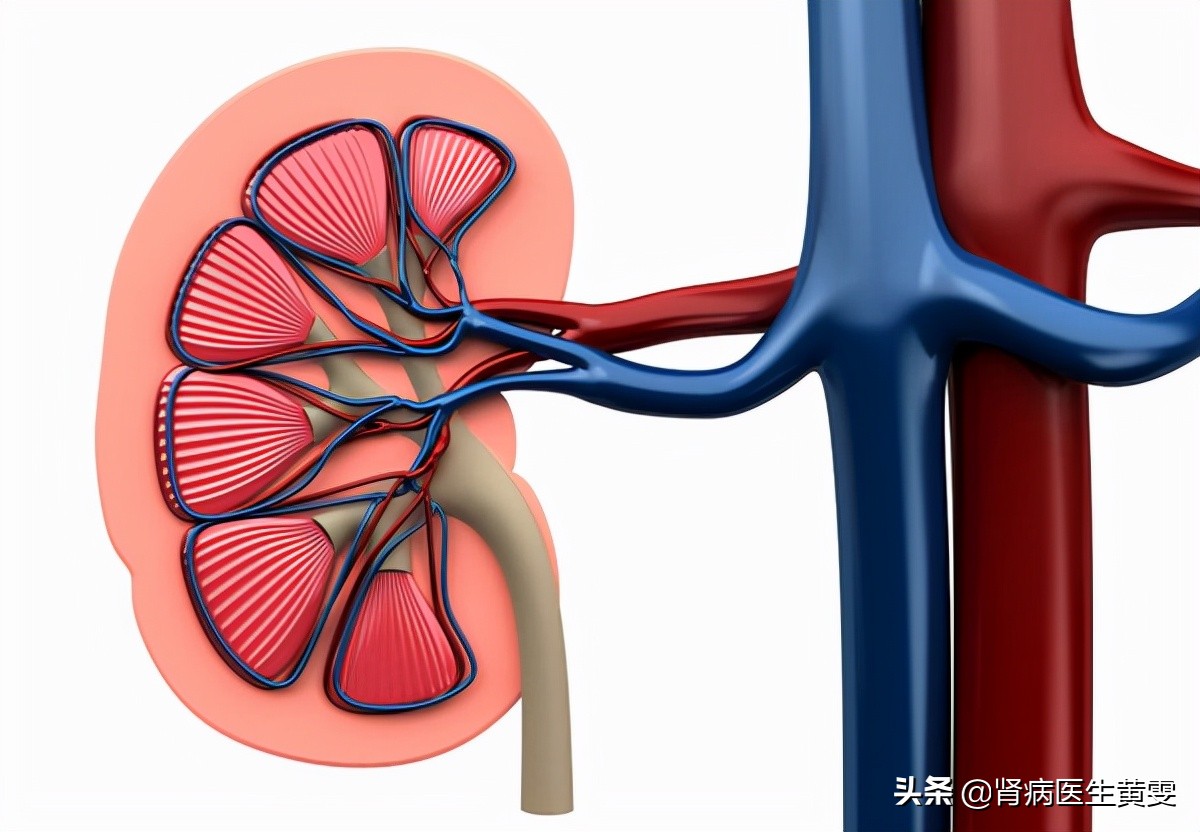 女性肾积水腰痛会影响小腿酸胀吗,肾积水腰疼怎么治疗需要住院吗