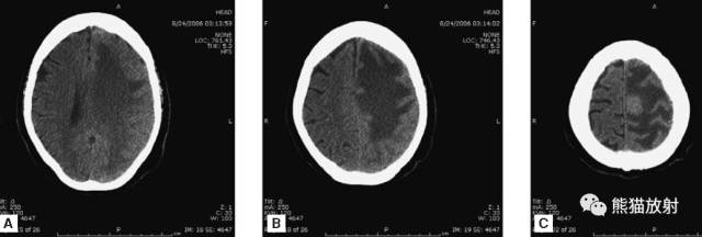 值夜班需要注意什么身体健康,值夜班的十大危害