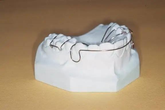 矫正牙齿反弹几率多大,矫正牙齿后没戴保持器反弹了