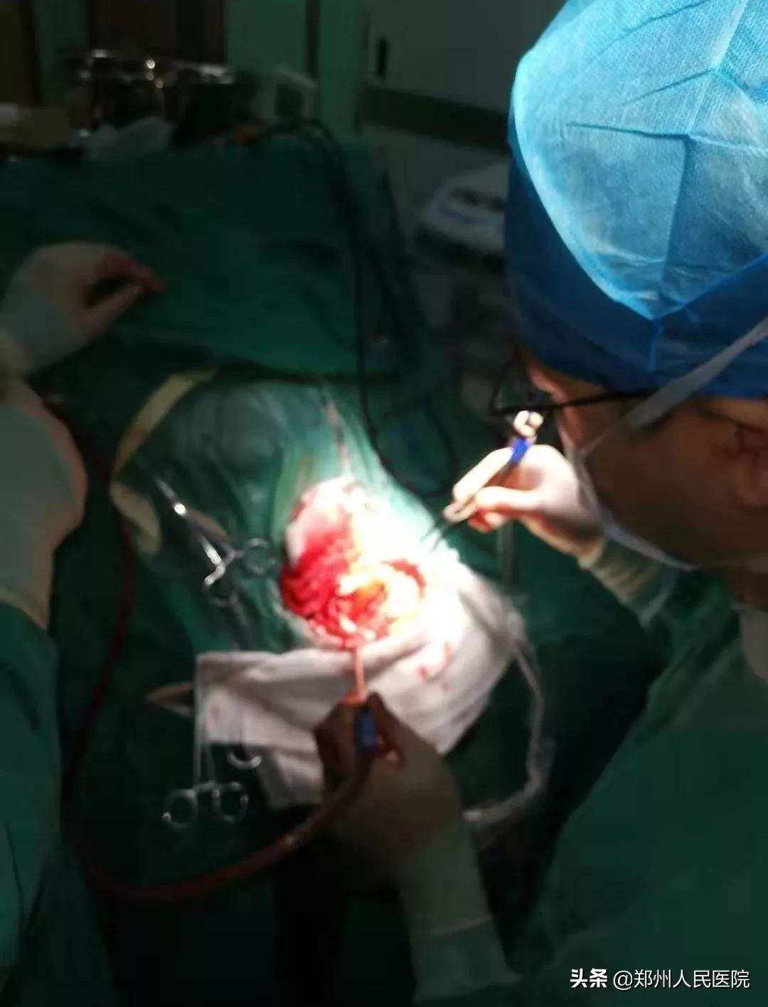 宝宝磕着额头有事吗,宝宝磕着嘴会有后遗症吗