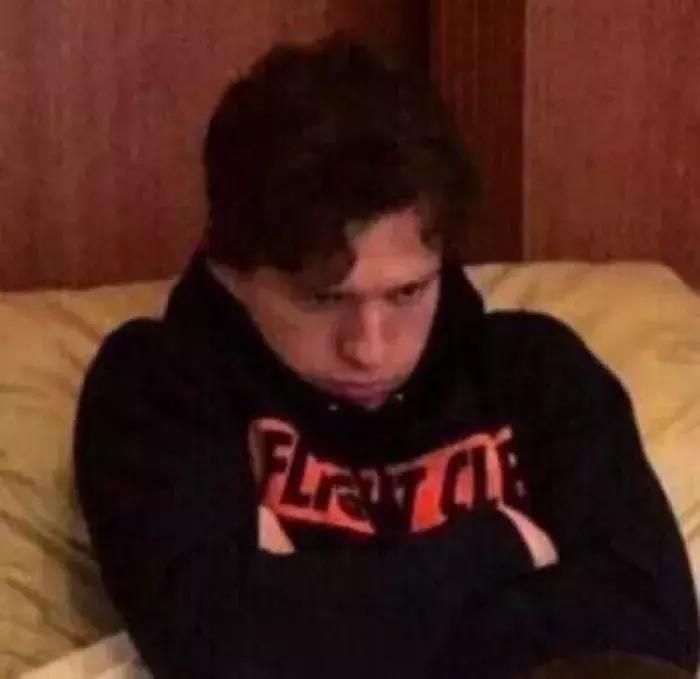 痘印根本治不住怎么办,痘印反反复复消不掉