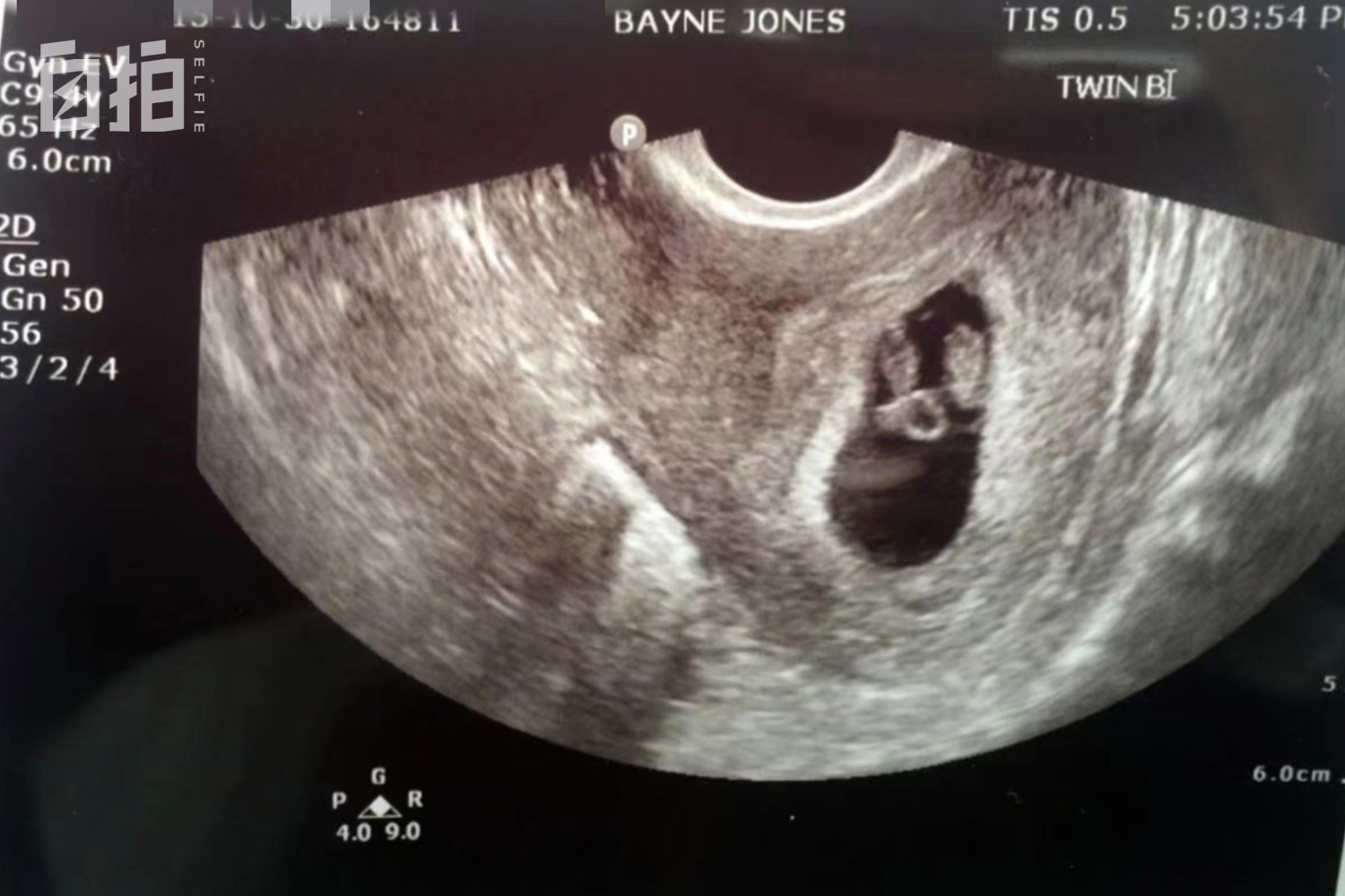 父母花百万出国留学,父母花了100多万供我去美国留学