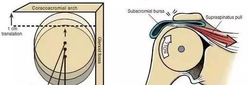 中医怎么看肩膀冈上肌疼痛,肩膀冈上肌疼痛