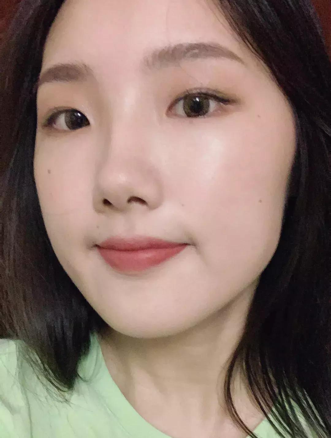 去割双眼皮,去韩国割双眼皮科学不