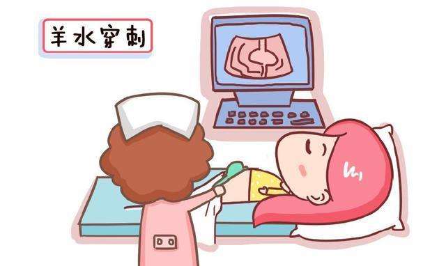 怀孕四个月了应该产检哪些项目,怀孕四个月应该产检什么