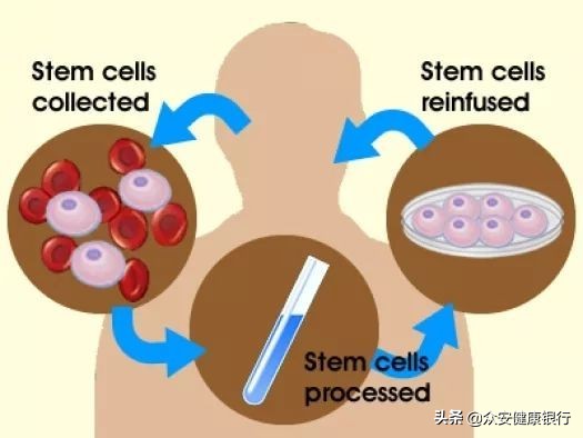造血干细胞移植的复发率图表,造血干细胞移植风险
