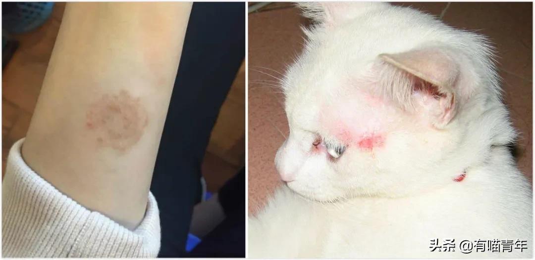 建国后有被猫抓伤得狂犬病的吗,不小心被猫抓伤了要打疫苗吗