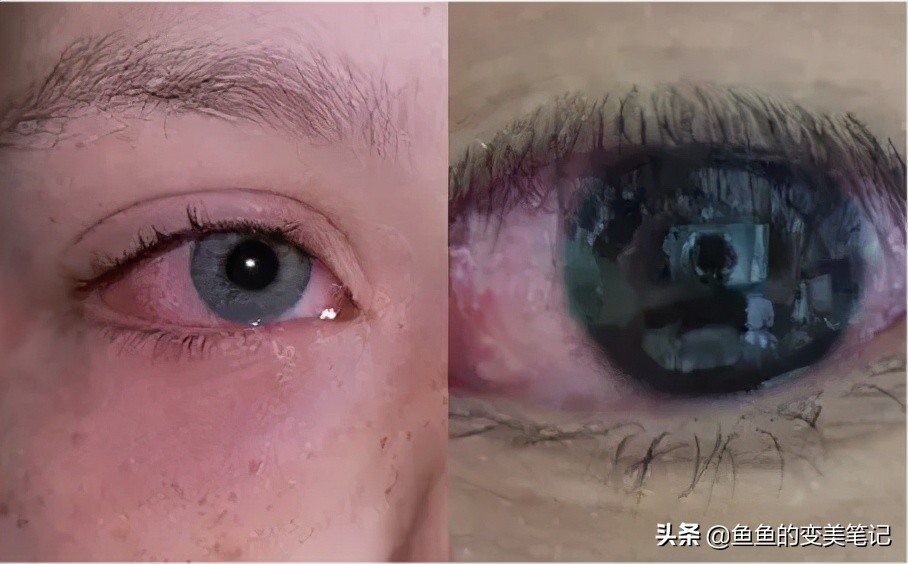 怎么选美瞳和护理美瞳,如何选择美瞳和妆容