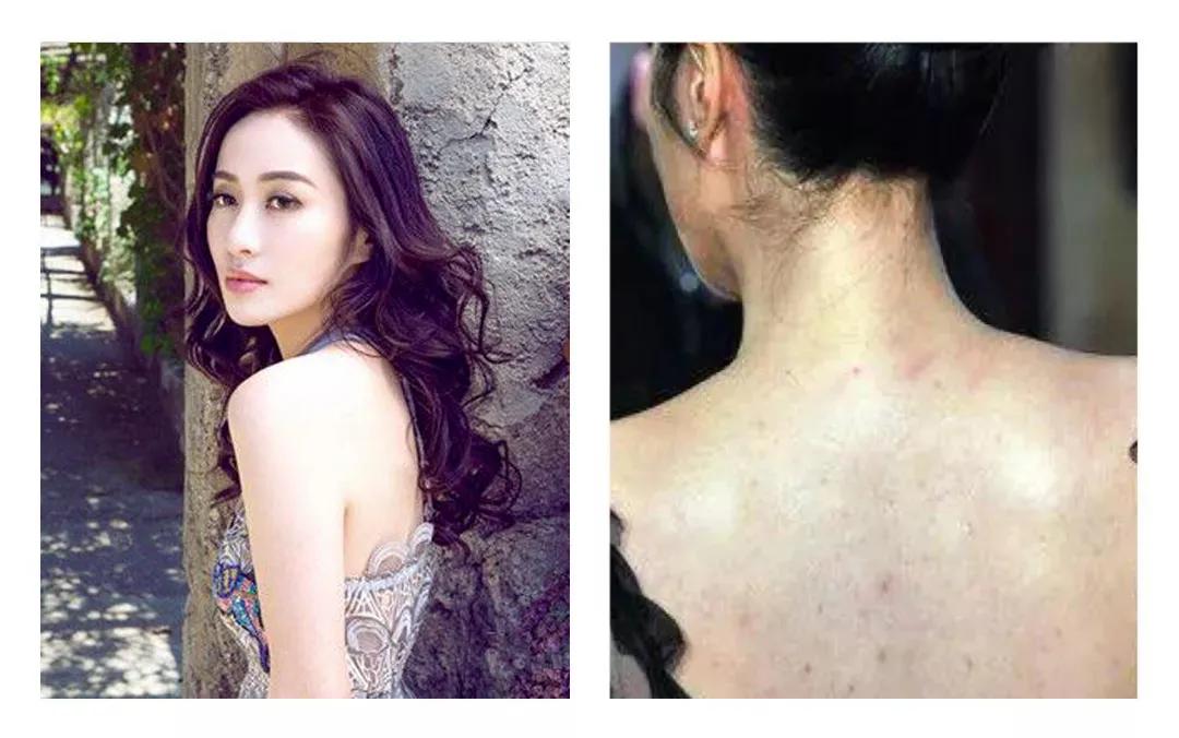 夏天做好6件事皮肤好到尖叫,这个夏天做好一件事