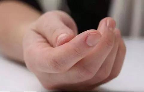 手指割破了是有什么事情要发生吗,手指割破了不能沾水