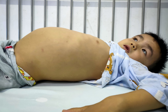 湖南8岁男孩体重仅40斤,小伙4岁失去双臂父亲精神失常