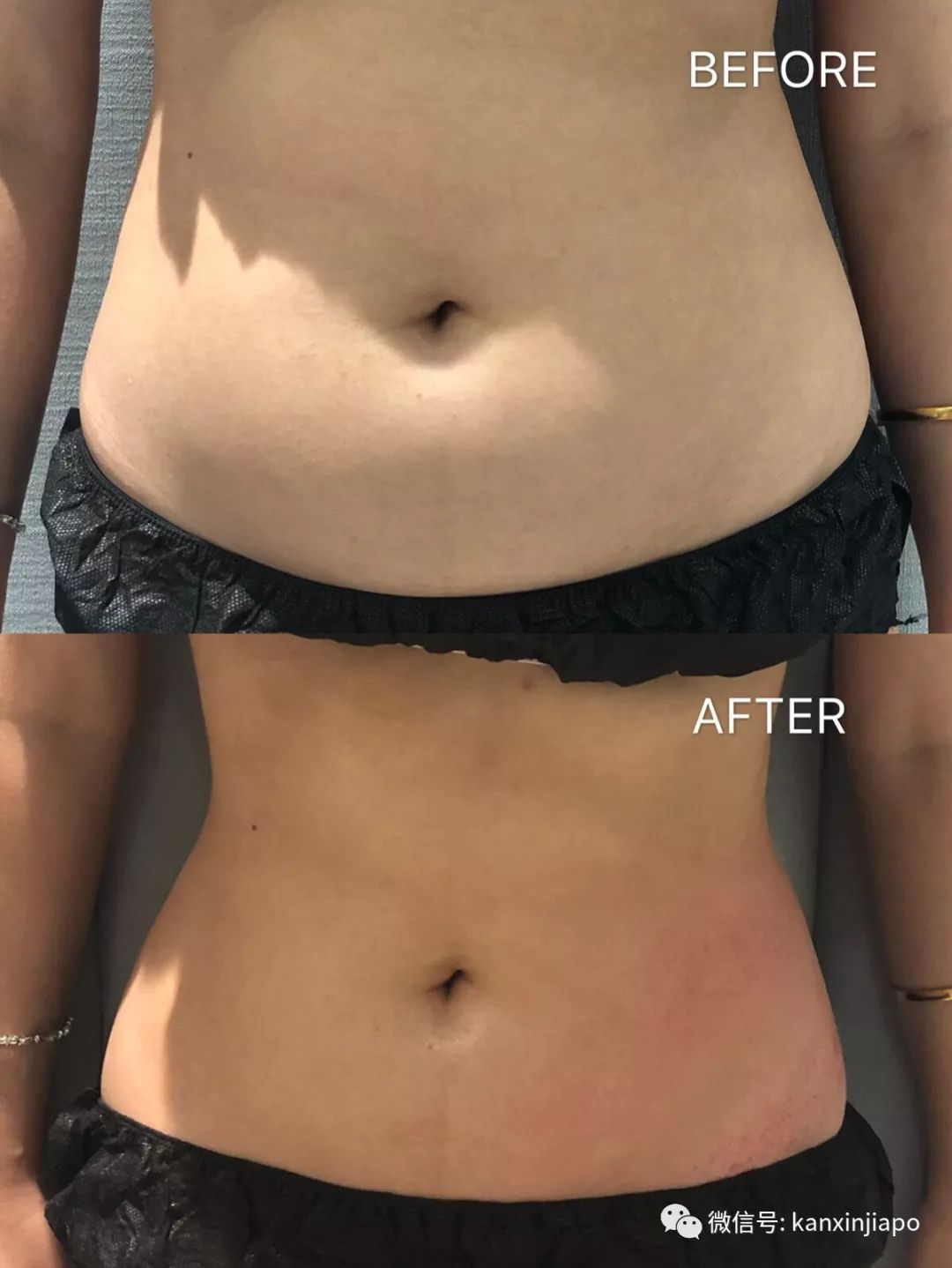 每周一次精准有效的皮肤管理,选对护肤方法让你做靓丽女神