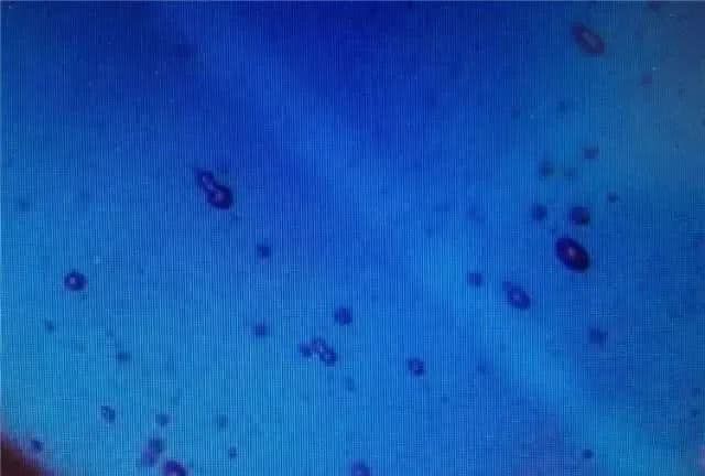 蓝宝石表面容易有脏东西,蓝宝石在家怎么辨别真假