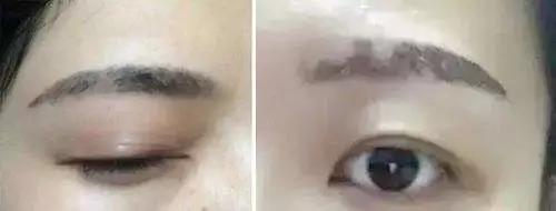 深圳传奇光学科技美容,深圳传奇光学祛斑仪器