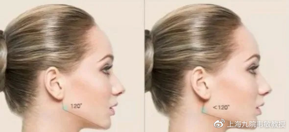 如何让侧颜变得好看,想拥有更好的线条