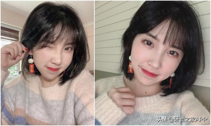 不靠整容怎么改变下巴后缩?看这里