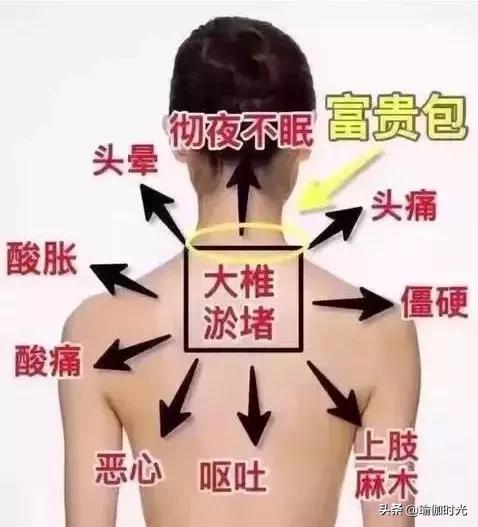 脾胃经络拉伸瑜伽视频,改善脖子后面大包的瑜伽方法