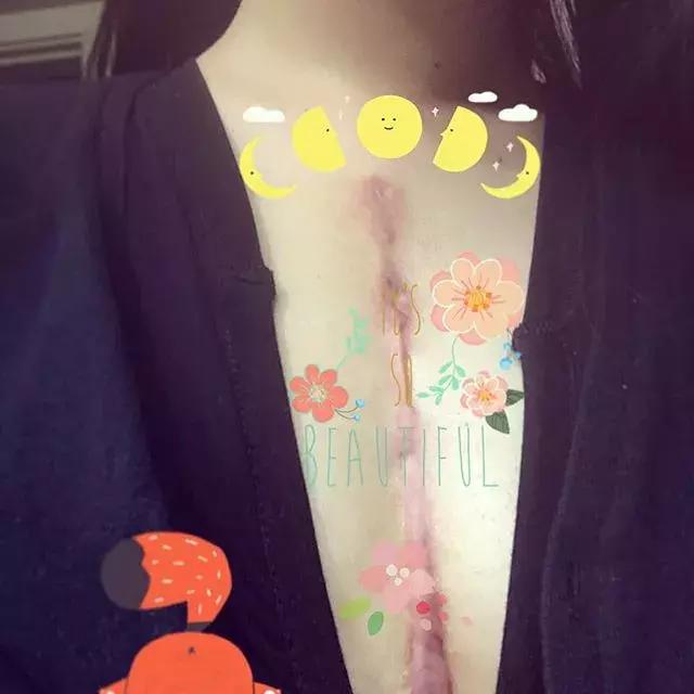 一个经历三次心脏手术，却依旧坚强，用水彩把伤痛化作星辰的女孩