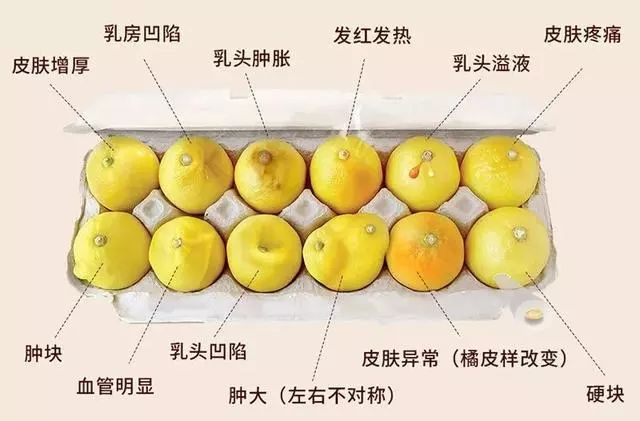 哺乳期怎么自查乳腺癌,哺乳期查出乳腺癌怎么办