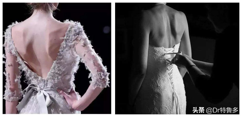 蝴蝶骨不是一种病吗,蝴蝶骨是颈椎病吗