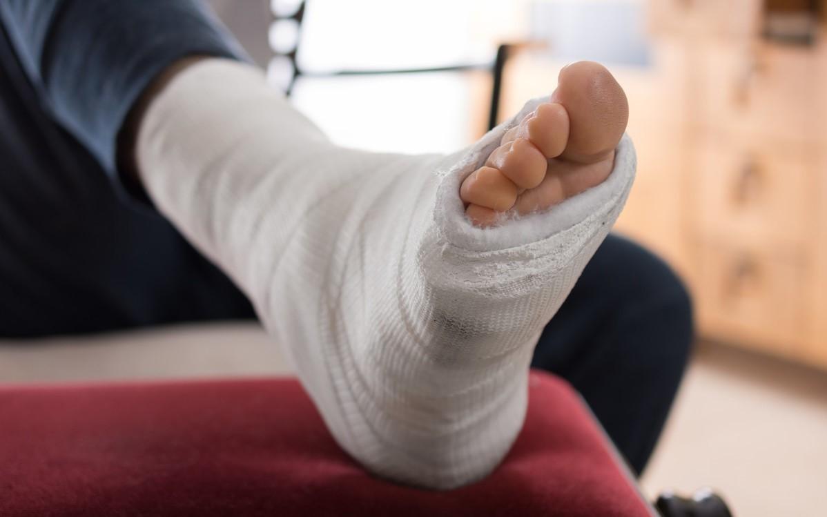 我的脚骨折打了石膏，医生说可能有生命危险，他是不是在骗我？