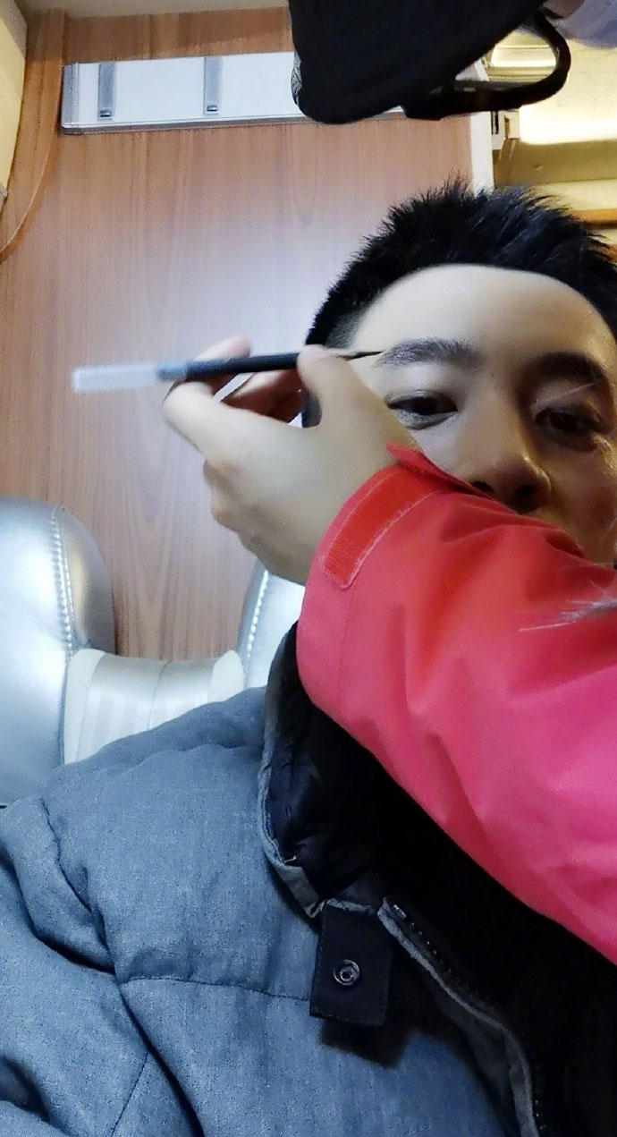 俞灏明的脸能修复吗,俞灏明的脸怎么修复的