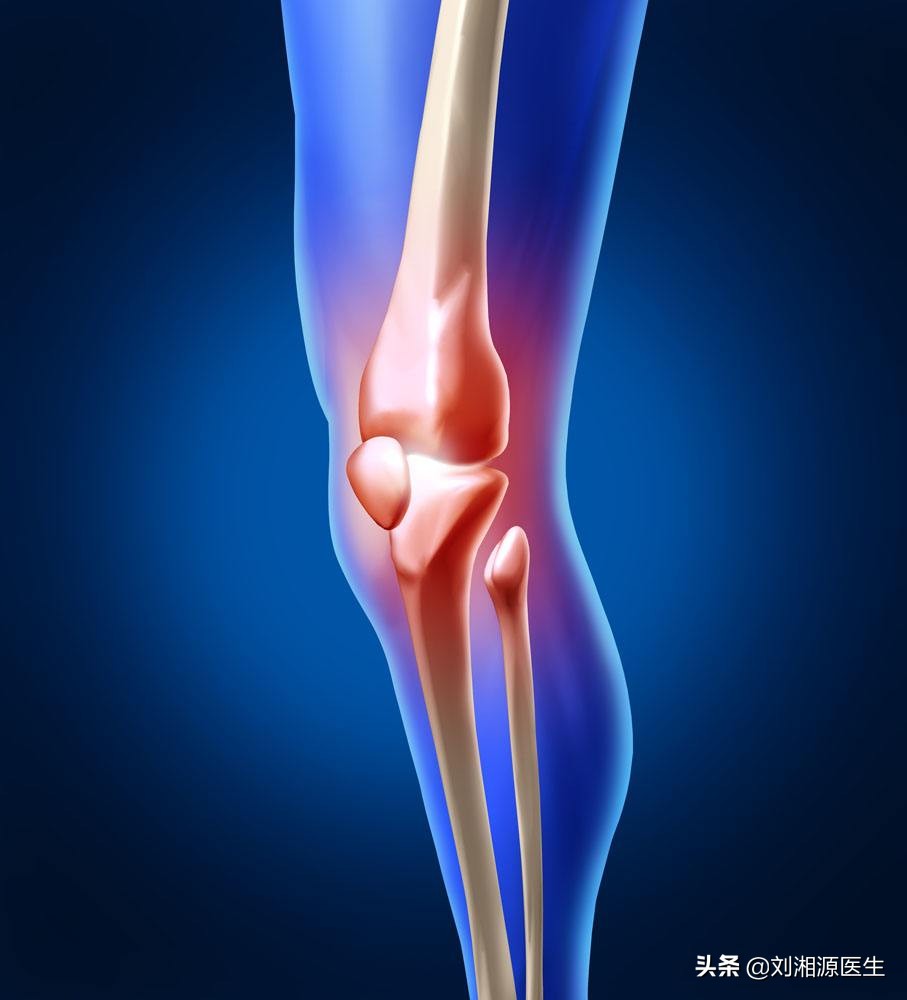 类风湿关节炎医生,得了类风湿怎么治疗不走弯路