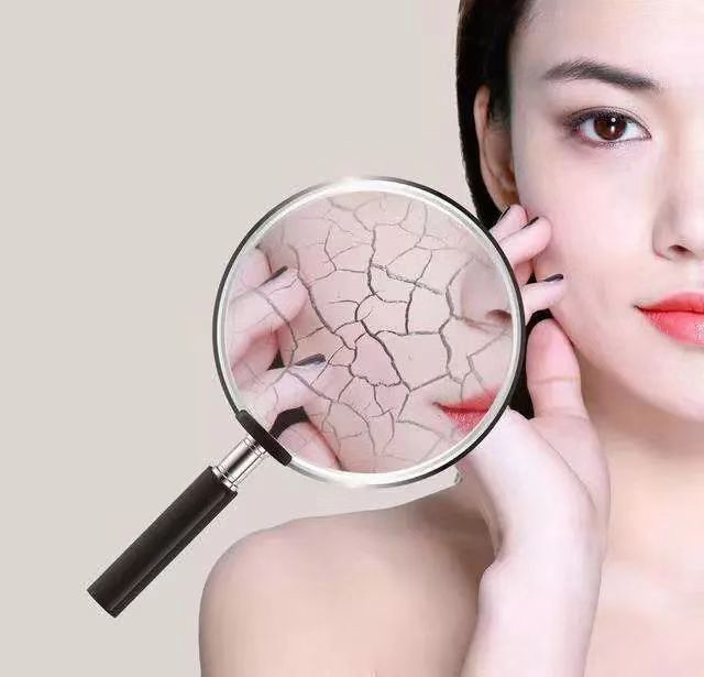 澳洲绵羊油与绵羊有关系吗,绵羊油和绵羊脂的区别