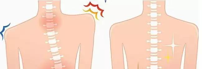 “减负”太遥远,现在我只想保住孩子的颈椎