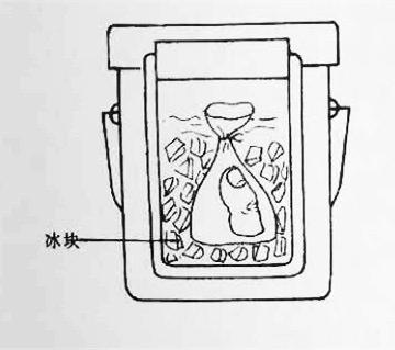 断指再植接动脉显微镜视频,穿针引线手术