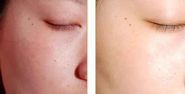 春雨蜂蜜面膜真实测评,春雨蜂蜜面膜用法及功效