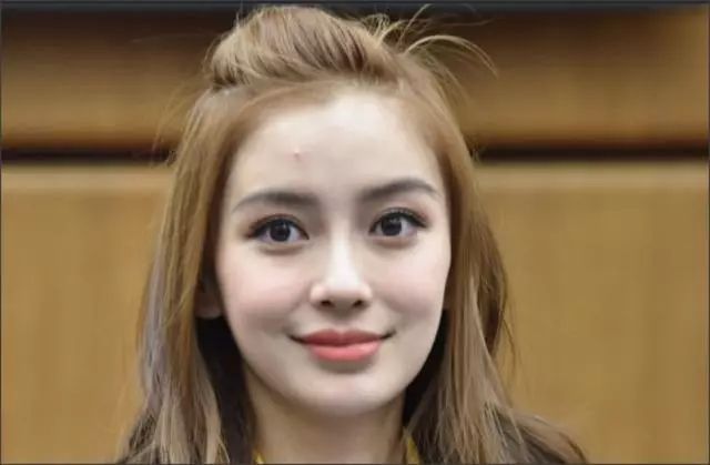 女星熬夜脸部痤疮,痘痘比较多的女明星