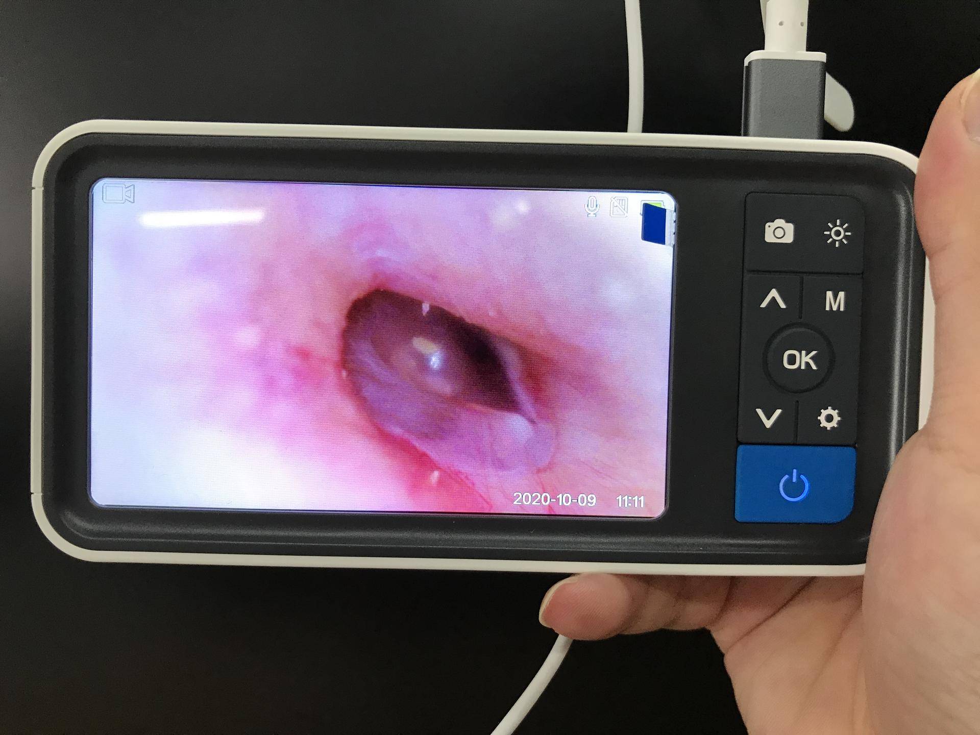 可视挖耳大屏,智能可视挖耳勺2毫米镜头