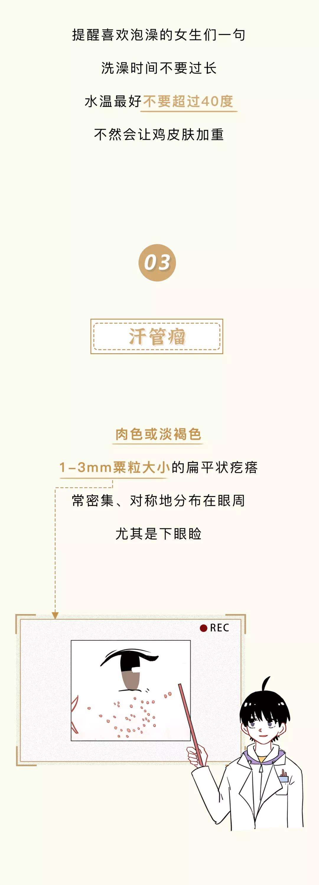 眼睛周围的脂肪粒到底是啥,眼睛周围长了脂肪粒怎么办