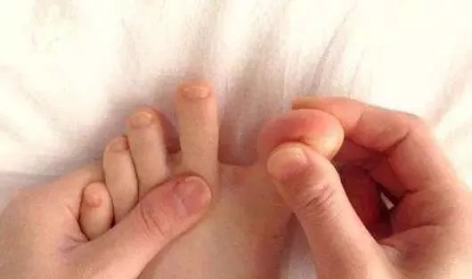 按揉脚方法,揉脚手法