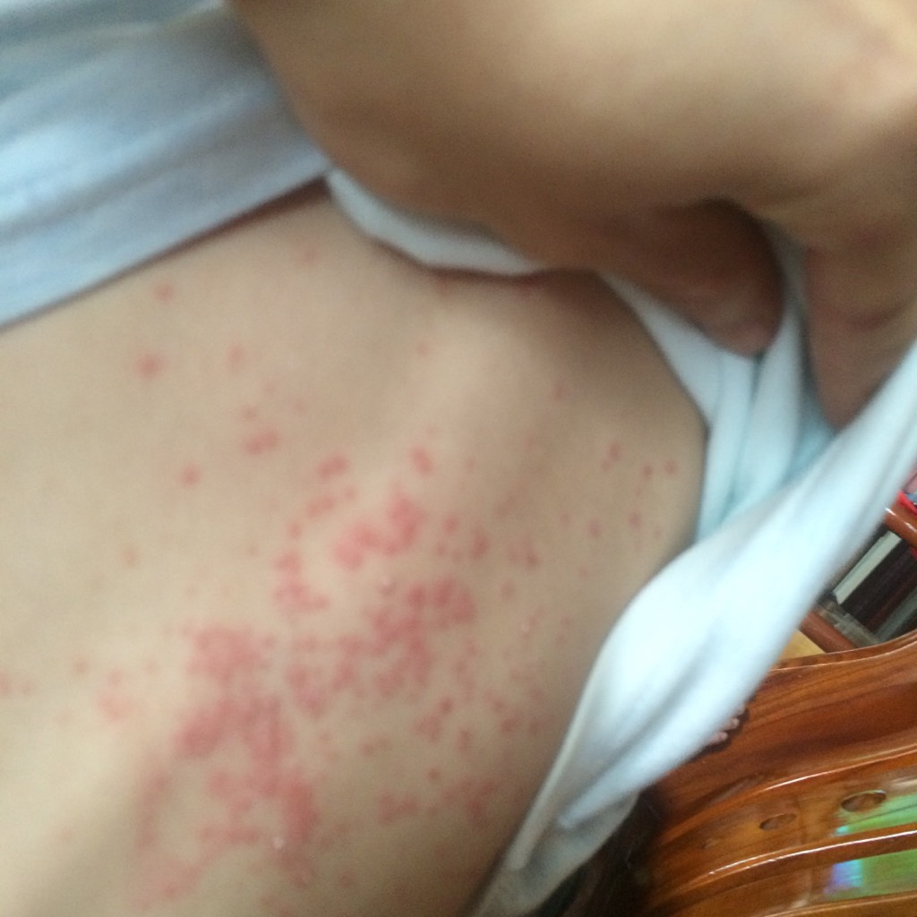 给孩子擦屁股用棉柔巾还是湿巾,给宝宝擦屁股用哪种湿巾