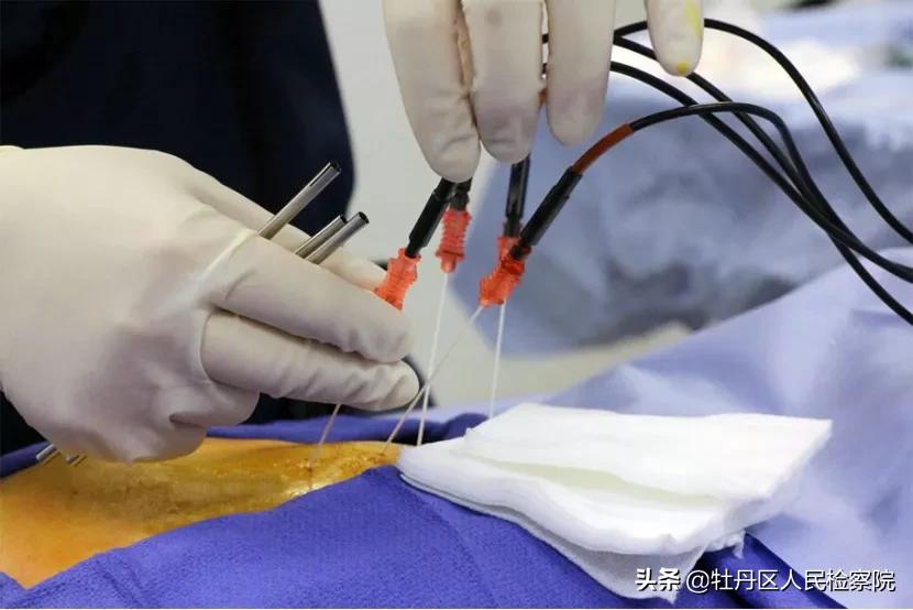 赵英俊肝癌做手术了吗,赵英俊肝癌做了手术没有