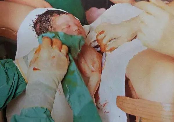 ella产后漏尿怎么办,ella产后尿失禁案例