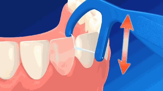 口臭时隐时现，刷牙漱口无作用，牙医教你几个小妙招轻松去口臭