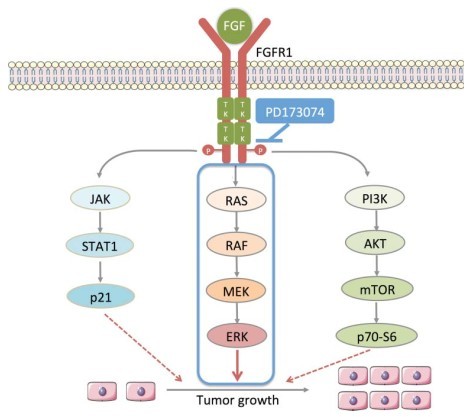 华西食管鳞状细胞癌专家,食道中分化鳞状细胞癌预后