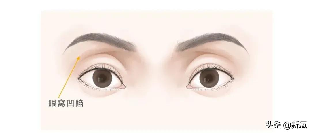 从万人嘲到万人捧,从万人嘲到万人迷