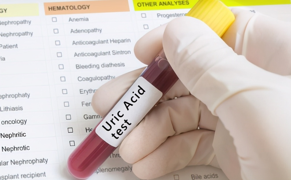 多喝水多长时间能使尿酸降下来,高尿酸血症多喝水降下来