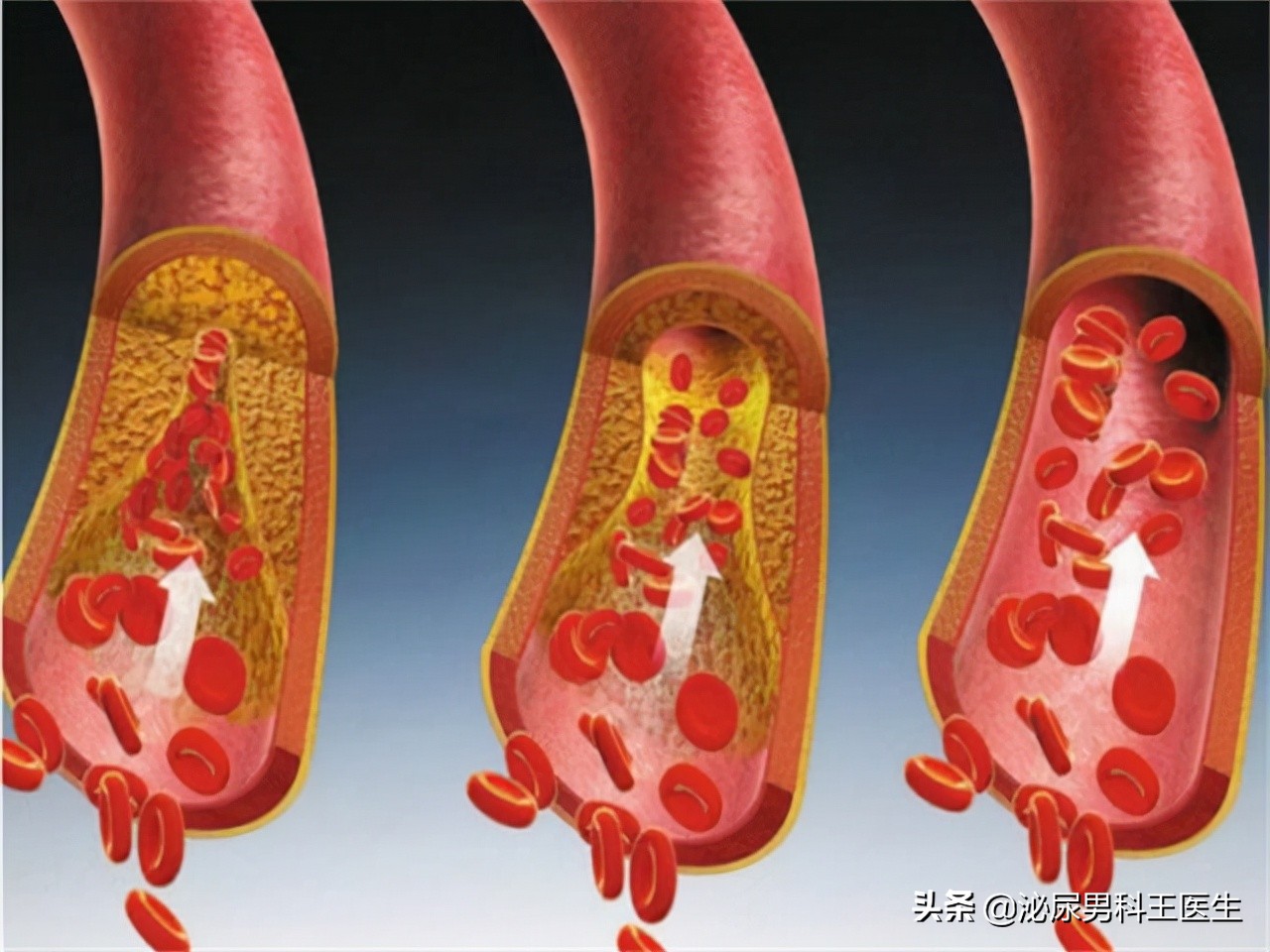 枸橼酸西地那非有没有治早泄功能,枸橼酸西地那非片有治病的功能吗