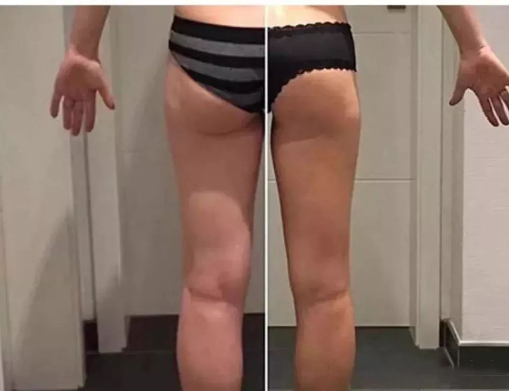 维密瘦身主要瘦哪些,维密瘦身法7天