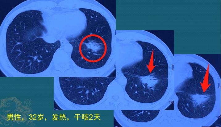 年轻人参观养鸡场，一个动作让他住院20天，损失3万块