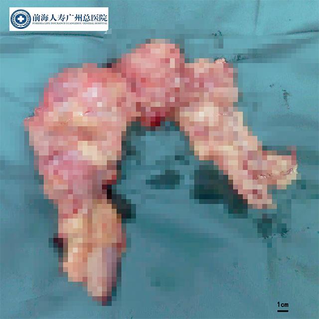 前海人寿广州总医院癌症科,前海人寿广州总医院心血管内科
